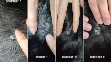 We Found a Black Mole On Our Dog – What We Did